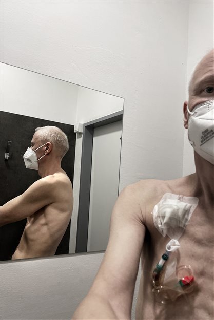 March 2025, another contrast agent into my body and CT organs